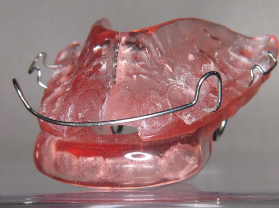 blokbeugel-activator-type-beugel-leiden